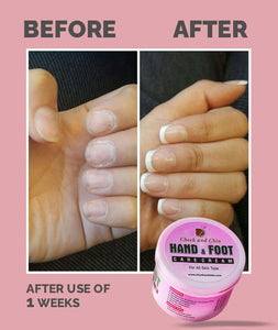 Hand & Foot Whitening Cream